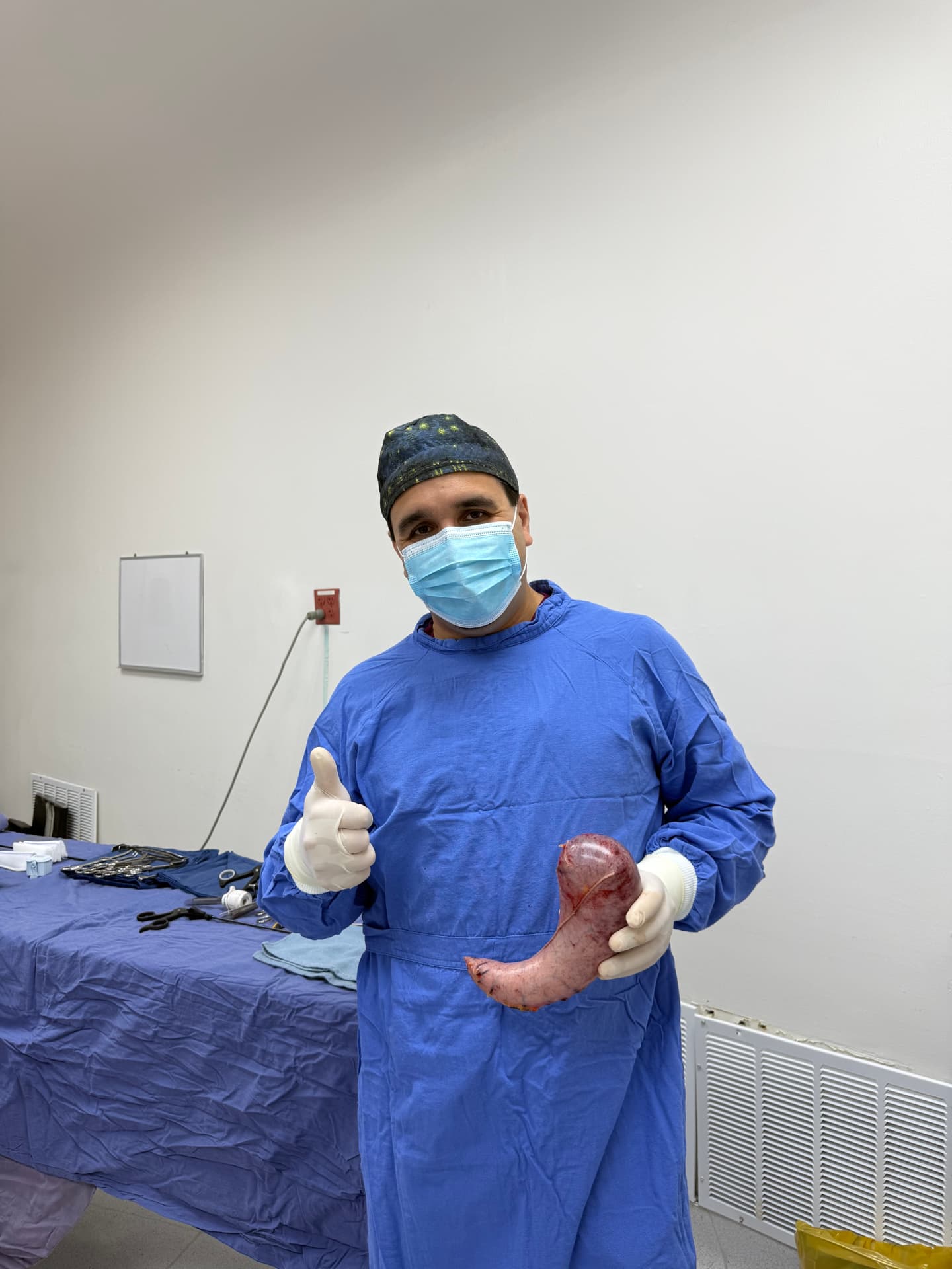 Dr. José Calderón mostrando el resultado de una cirugía bariátrica